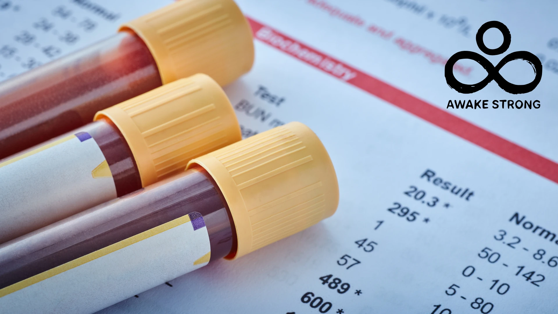 Functional vs. Conventional Blood Work: Why the Difference Matters for Your Health